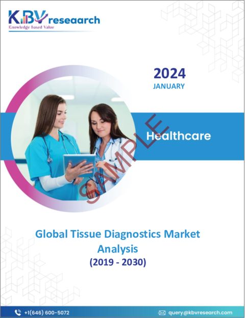 表紙：組織診断の世界市場規模、シェア、動向分析レポート：製品別、技術別、疾患タイプ別、エンドユーザー別、地域別展望と予測、2023年～2030年
