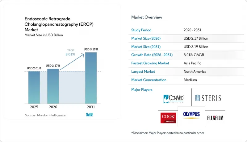 Endoscopic Retrograde Cholangiopancreatography(ERCP)-Market-IMG1