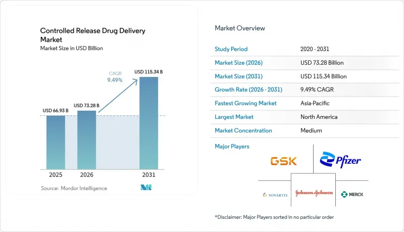 Controlled Release Drug Delivery-Market-IMG1