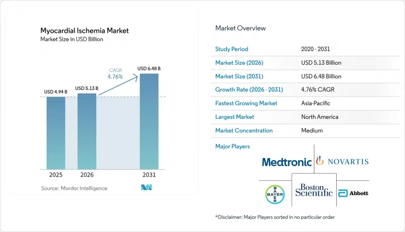 Myocardial Ischemia-Market-IMG1