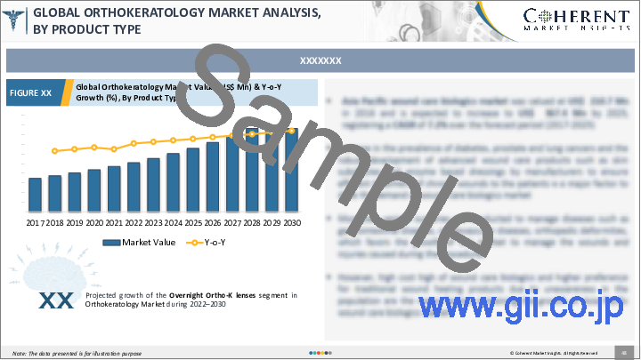 サンプル1：オルソケラトロジーの世界市場：規模、シェア、動向、予測（2022年～2028年）