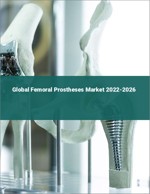 表紙：人工大腿骨の世界市場：2022年～2026年