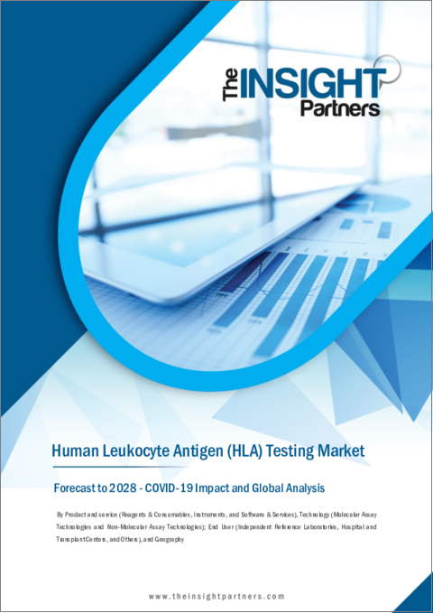 表紙：ヒト白血球型抗原検査の世界市場予測（2028年まで）：製品・サービス、技術、エンドユーザー、地域別の分析