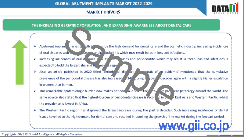 サンプル2：アバットメントインプラントの世界市場（2022年～2029年）