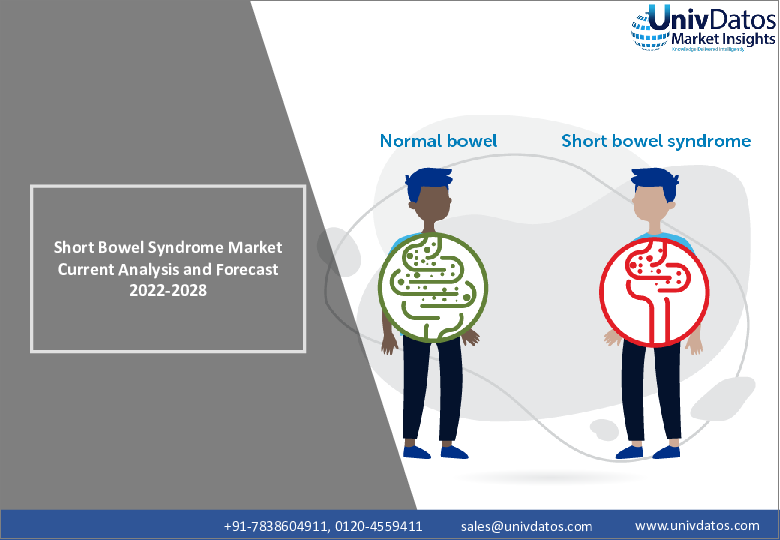 表紙：短腸症候群（SBS）の世界市場：現状分析と予測（2021年～2027年）