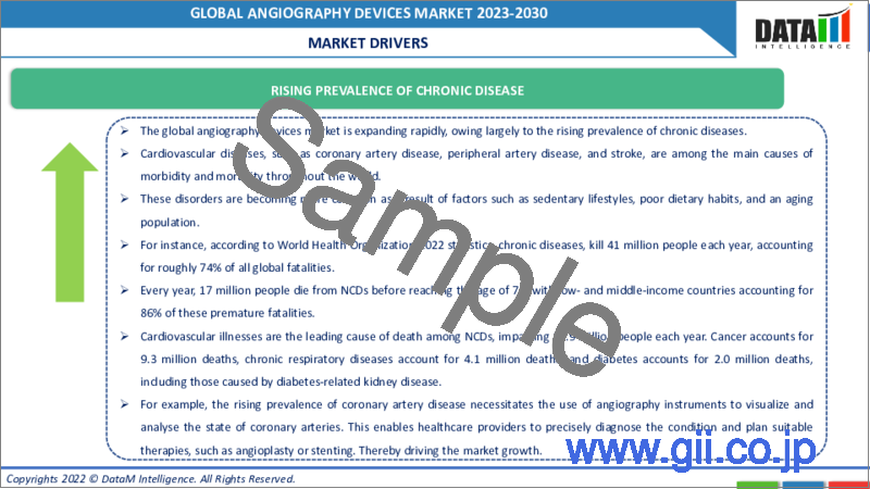 サンプル2：血管造影装置の世界市場-2023-2030