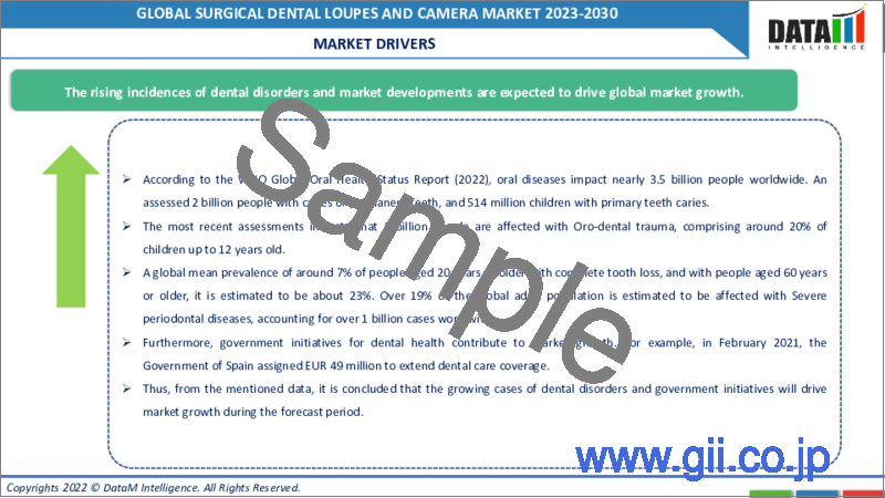 サンプル2：外科用デンタルルーペとカメラの世界市場-2023-2030