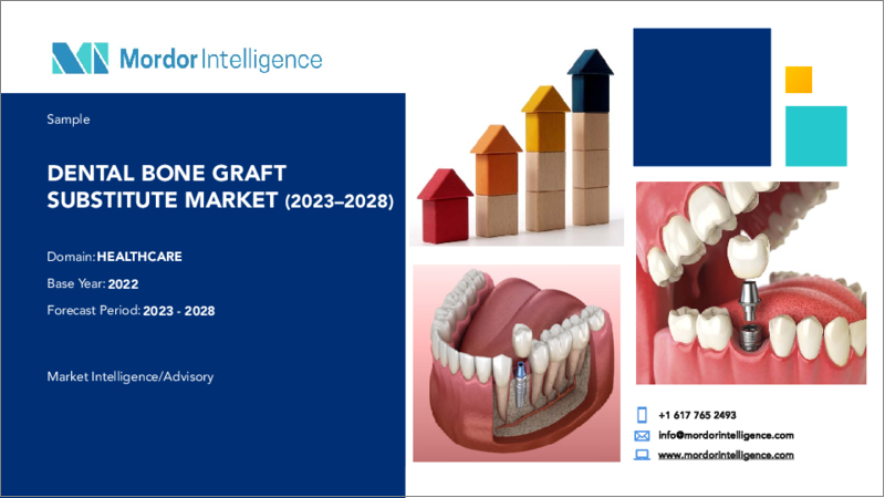 表紙：歯科用骨補填材市場- 成長、動向、予測（2023年-2028年）