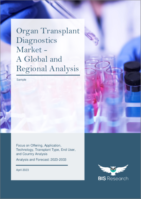 表紙：臓器移植診断の世界市場 (2023-2033年)：提供区分・用途・技術・移植タイプ・エンドユーザー・地域/国別の分析・予測