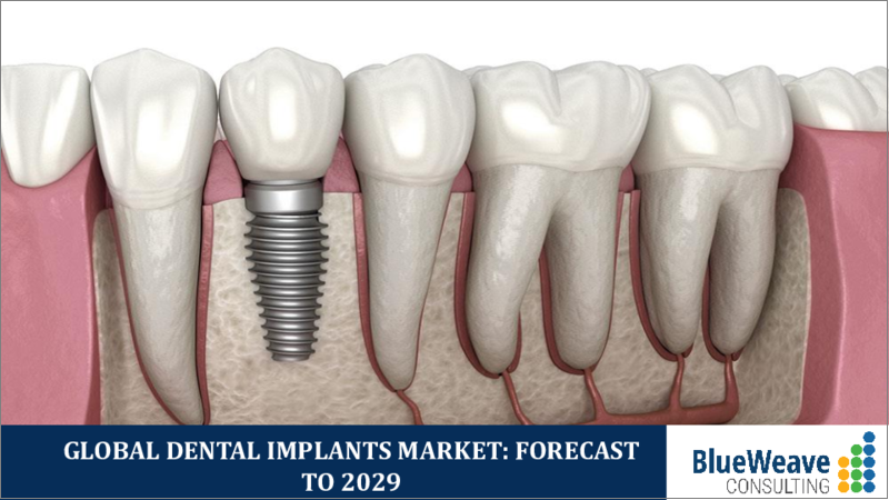 表紙：歯科用インプラントの世界市場 (2019-2029年)：材料・設計・タイプ・エンドユーザー・地域別の市場規模・シェア・動向分析・機会・予測