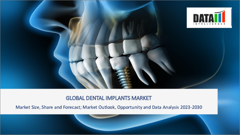 表紙：歯科インプラントの世界市場-2023年～2030年