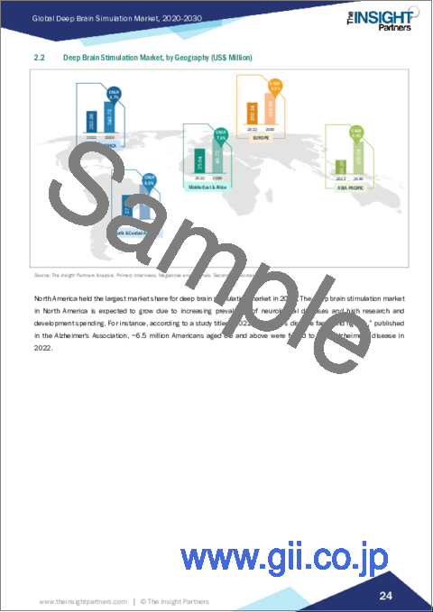 サンプル1：脳深部刺激療法の2030年までの市場予測-製品、用途、エンドユーザー別の世界分析