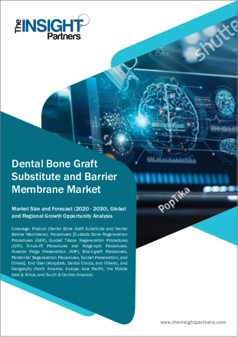 表紙：歯科用骨移植片とバリア膜の2030年までの市場予測-製品、処置、エンドユーザー、地域別の世界分析