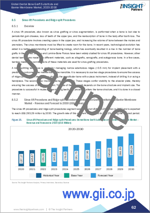 サンプル2：歯科用骨移植片とバリア膜の2030年までの市場予測-製品、処置、エンドユーザー、地域別の世界分析