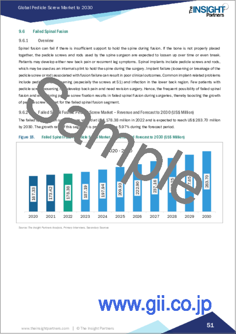 サンプル2：ペディキュラスクリュー市場規模・動向、世界・地域シェア、動向、成長機会分析レポート対象範囲製品タイプ別、用途別、手術タイプ別、エンドユーザー別、地域別