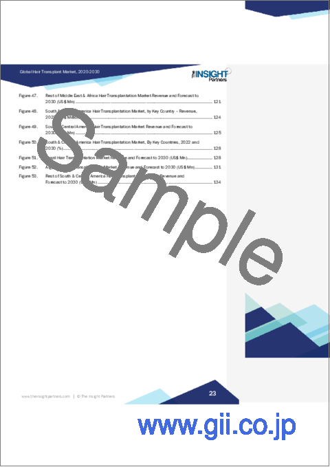 サンプル1：植毛の市場規模・予測、世界・地域別シェア、動向、成長機会分析レポート範囲：施術法別、移植部位別、地域別