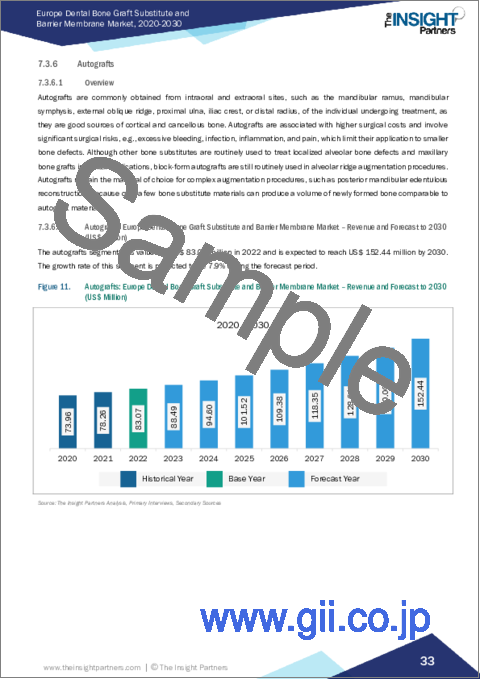 サンプル2：欧州の歯科用骨移植代替物およびバリアメンブレンの2030年までの市場予測- 地域別分析- 製品別、手技別、エンドユーザー別