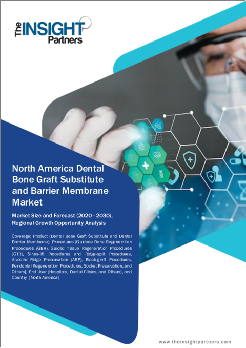 表紙：北米の歯科用骨移植代替物およびバリアメンブレン市場の2030年までの予測-地域別分析-製品、手法、エンドユーザー