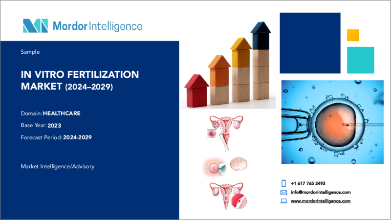 表紙：体外受精-市場シェア分析、産業動向と統計、2024～2029年の成長予測