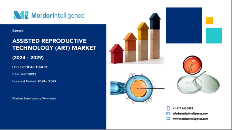 表紙：生殖補助医療（ART）：市場シェア分析、産業動向・統計、2024～2029年成長予測