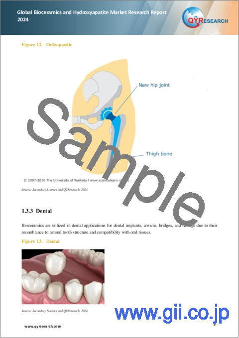 サンプル1：バイオセラミックスおよびハイドロキシアパタイトの世界市場：2024年