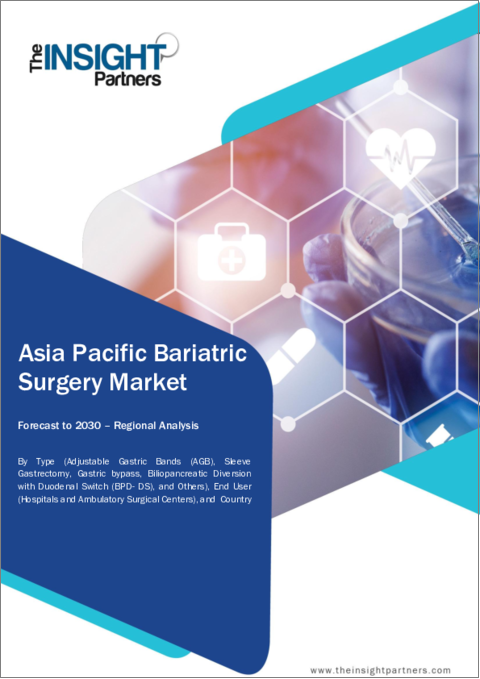 表紙：アジア太平洋の肥満手術：2030年市場予測-地域別分析-タイプ別、エンドユーザー別