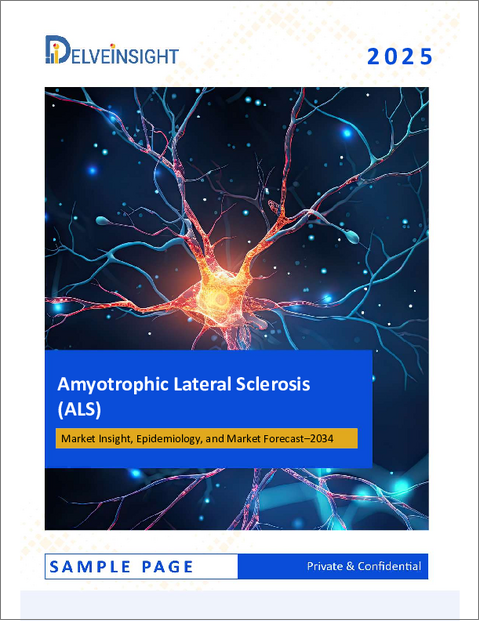 表紙：筋萎縮性側索硬化症（ALS）市場 - 市場の洞察、疫学、市場予測：2034年