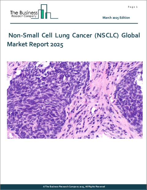 表紙：非小細胞肺がん（NSCLC）の世界市場：2025年