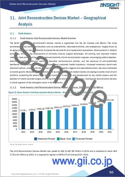 サンプル2：関節再建デバイス市場規模と予測（2021年～2031年）、世界のおよび地域別シェア、動向、成長機会分析レポート：タイプ別、技術別、エンドユーザー別、地域別